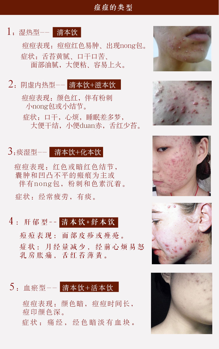 清本飲-濕熱8.jpg